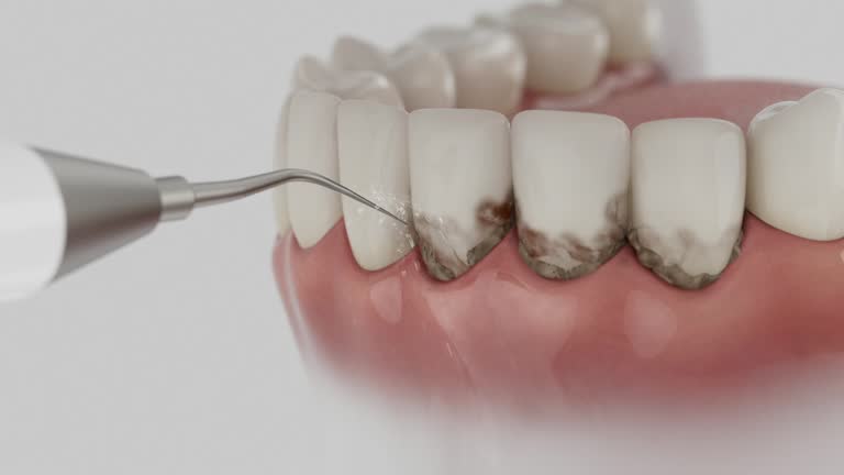 Reliable Dental Implants contractor in Leesburg, FL by Smile Center Dentistry